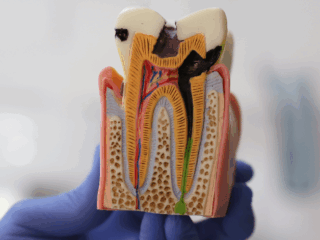 https://www.stefanoudentalclinic.gr/wp-content/uploads/2025/05/ενδοδοντια-320x240.png