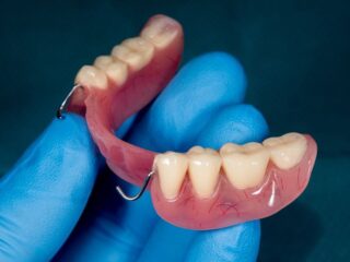 https://www.stefanoudentalclinic.gr/wp-content/uploads/2025/06/μερικη-οδοντοστοιχια-320x240.jpg