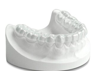 https://www.stefanoudentalclinic.gr/wp-content/uploads/2025/06/ναρθηκας-βρυγμου-1-320x240.jpg